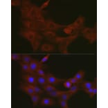 Immunofluorescence - Anti-TRAF7 Antibody (A14346) - Antibodies.com