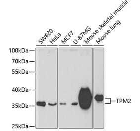 Western Blot - Anti-Tropomyosin 2 Antibody (A14347) - Antibodies.com