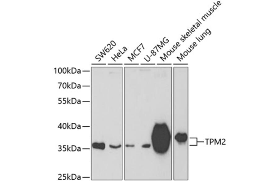 Western Blot - Anti-Tropomyosin 2 Antibody (A14347) - Antibodies.com