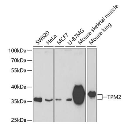 Western Blot - Anti-Tropomyosin 2 Antibody (A14347) - Antibodies.com