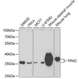 Western Blot - Anti-Tropomyosin 2 Antibody (A14347) - Antibodies.com