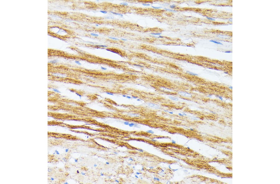 Immunohistochemistry - Anti-Tropomyosin 2 Antibody (A14347) - Antibodies.com