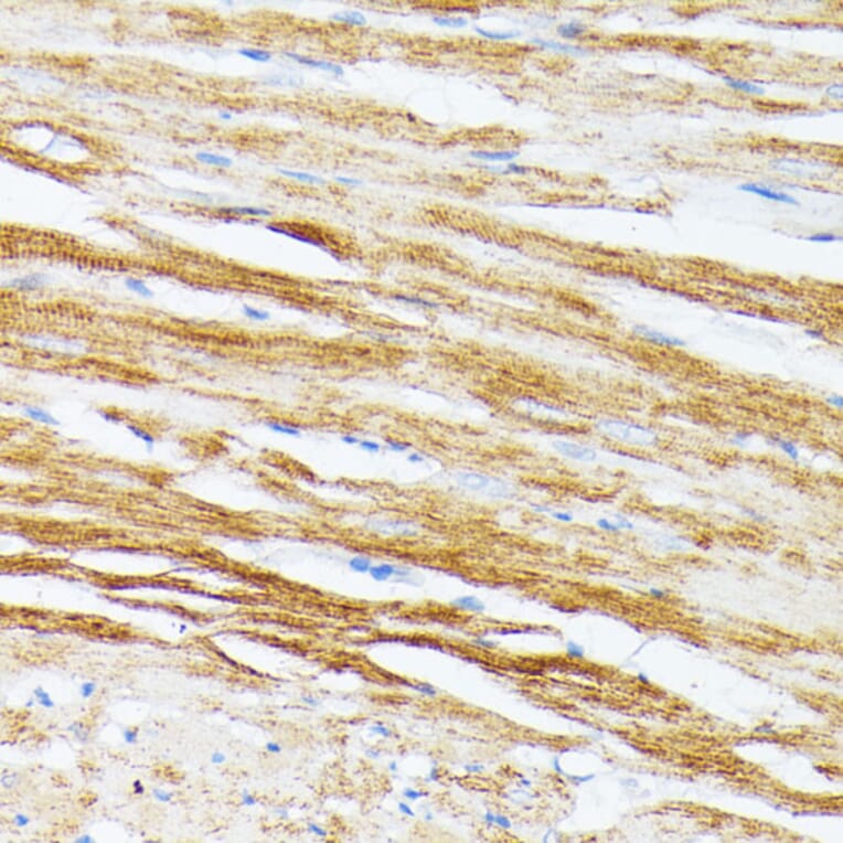 Immunohistochemistry - Anti-Tropomyosin 2 Antibody (A14347) - Antibodies.com