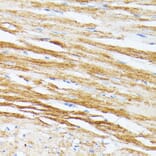 Immunohistochemistry - Anti-Tropomyosin 2 Antibody (A14347) - Antibodies.com
