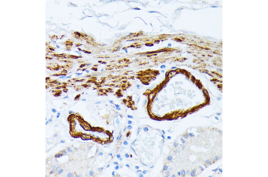 Immunohistochemistry - Anti-Tropomyosin 2 Antibody (A14347) - Antibodies.com