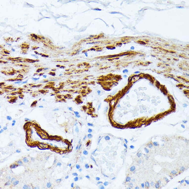 Immunohistochemistry - Anti-Tropomyosin 2 Antibody (A14347) - Antibodies.com