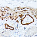 Immunohistochemistry - Anti-Tropomyosin 2 Antibody (A14347) - Antibodies.com