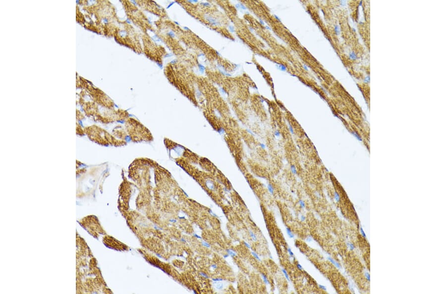 Immunohistochemistry - Anti-Tropomyosin 2 Antibody (A14347) - Antibodies.com