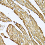 Immunohistochemistry - Anti-Tropomyosin 2 Antibody (A14347) - Antibodies.com