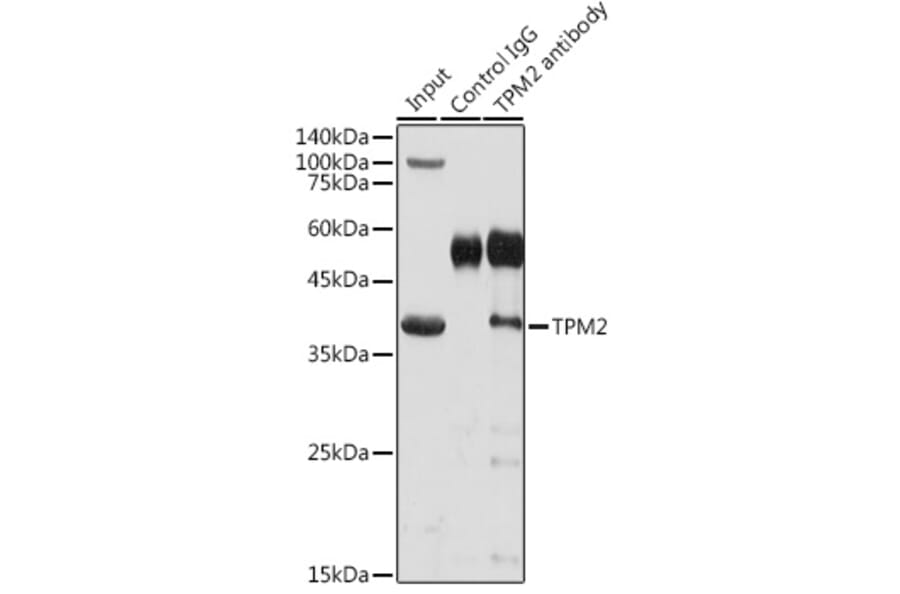 Western Blot - Anti-Tropomyosin 2 Antibody (A14347) - Antibodies.com