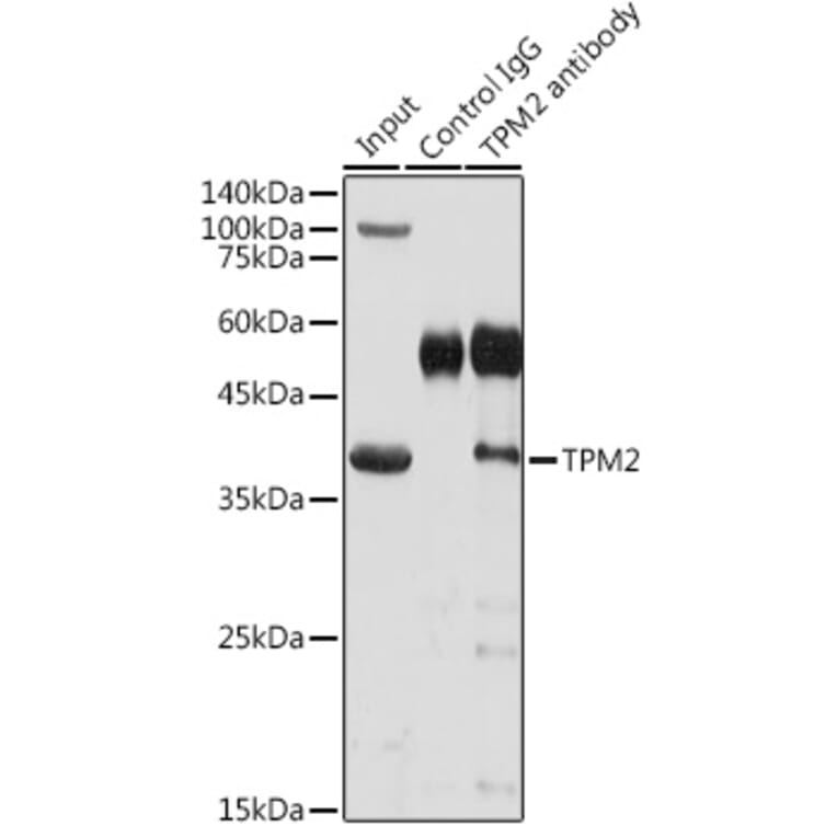 Western Blot - Anti-Tropomyosin 2 Antibody (A14347) - Antibodies.com