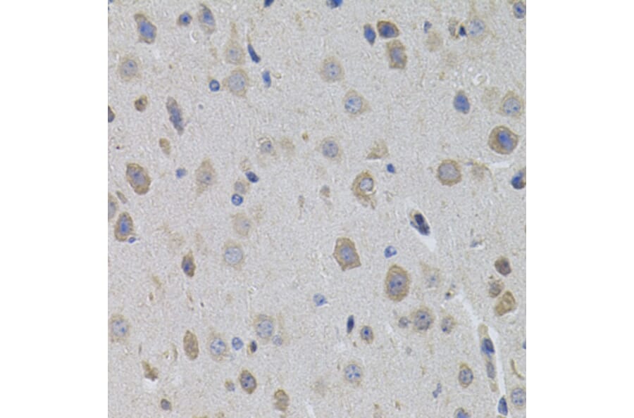 Immunohistochemistry - Anti-Sumo 3 Antibody (A14349) - Antibodies.com