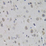 Immunohistochemistry - Anti-Sumo 3 Antibody (A14349) - Antibodies.com