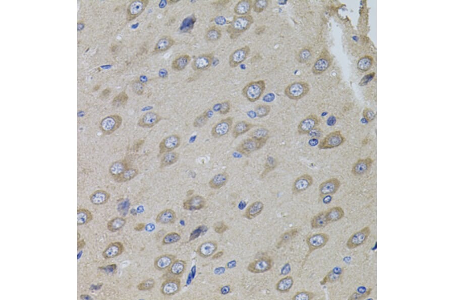 Immunohistochemistry - Anti-Sumo 3 Antibody (A14349) - Antibodies.com