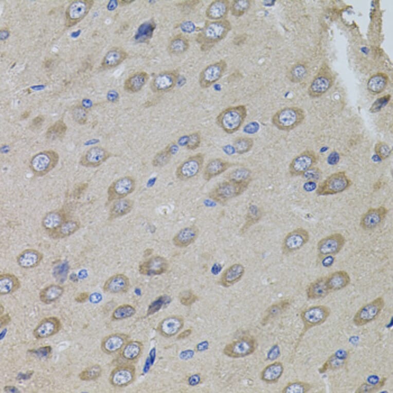 Immunohistochemistry - Anti-Sumo 3 Antibody (A14349) - Antibodies.com