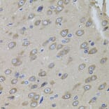Immunohistochemistry - Anti-Sumo 3 Antibody (A14349) - Antibodies.com