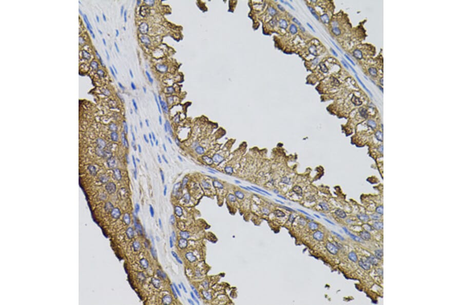 Immunohistochemistry - Anti-Sumo 3 Antibody (A14349) - Antibodies.com
