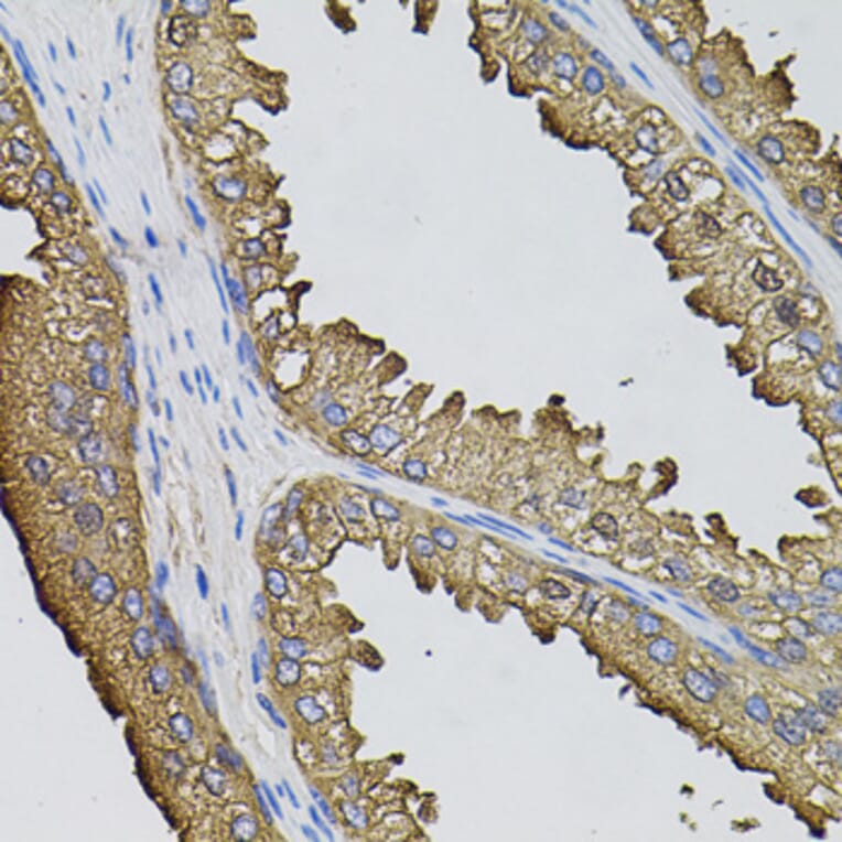 Immunohistochemistry - Anti-Sumo 3 Antibody (A14349) - Antibodies.com