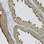 Immunohistochemistry - Anti-Sumo 3 Antibody (A14349) - Antibodies.com