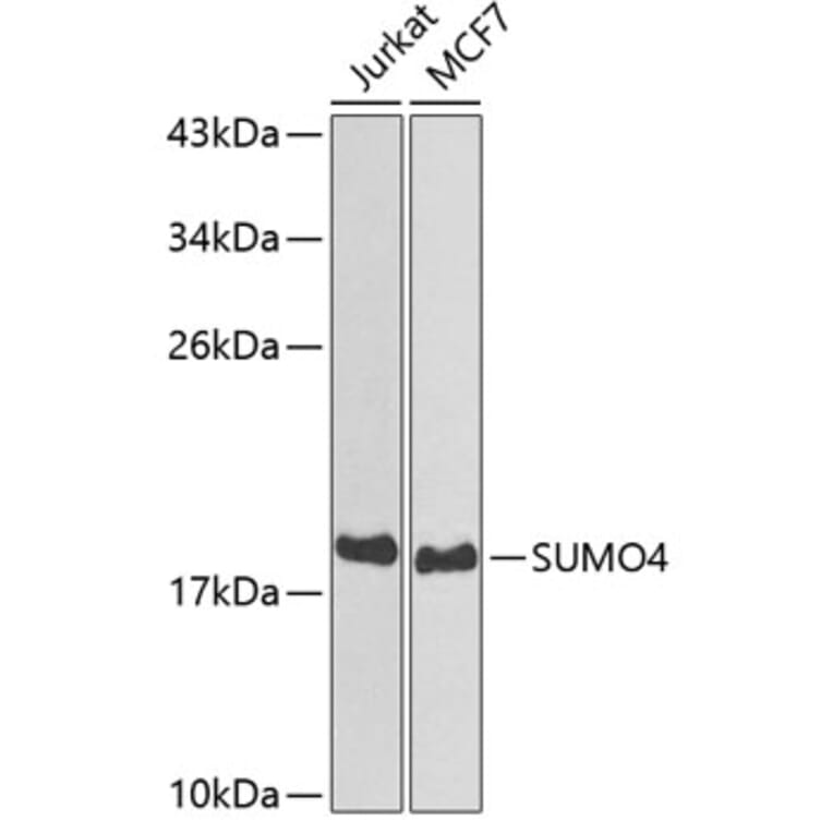 Western Blot - Anti-Sumo4 Antibody (A14350) - Antibodies.com