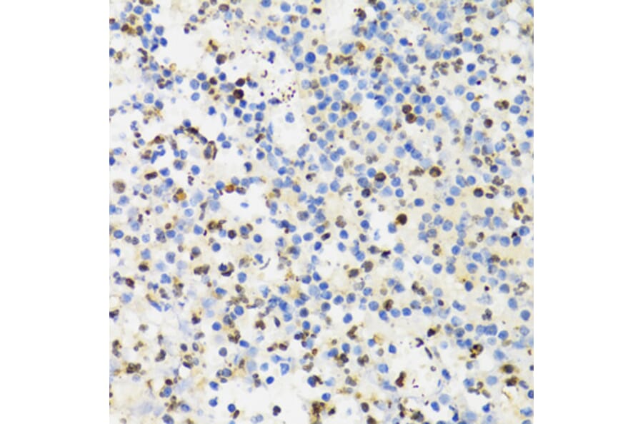 Immunohistochemistry - Anti-Sumo4 Antibody (A14350) - Antibodies.com