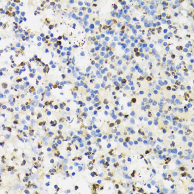 Immunohistochemistry - Anti-Sumo4 Antibody (A14350) - Antibodies.com