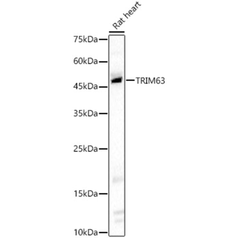 Western Blot - Anti-MURF1 Antibody (A14351) - Antibodies.com