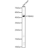 Western Blot - Anti-MURF1 Antibody (A14351) - Antibodies.com