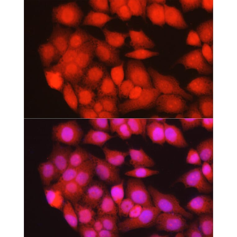 Immunofluorescence - Anti-MURF1 Antibody (A14351) - Antibodies.com