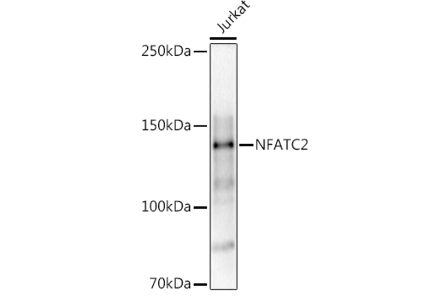 Western Blot - Anti-NFAT1 Antibody (A14355) - Antibodies.com