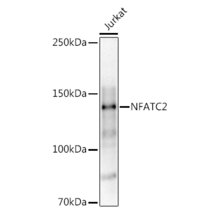 Western Blot - Anti-NFAT1 Antibody (A14355) - Antibodies.com