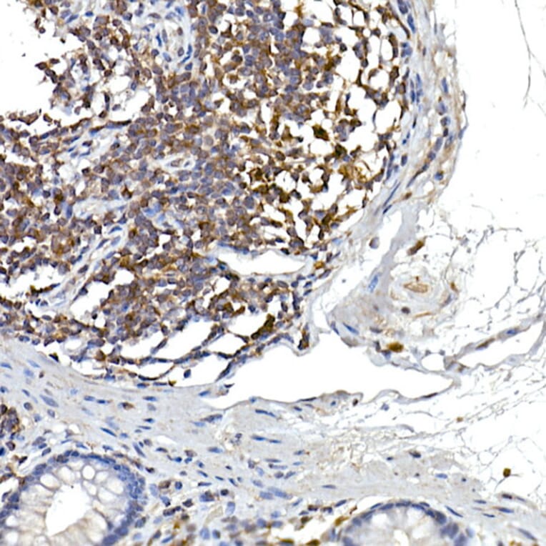 Immunohistochemistry - Anti-NFAT1 Antibody (A14355) - Antibodies.com