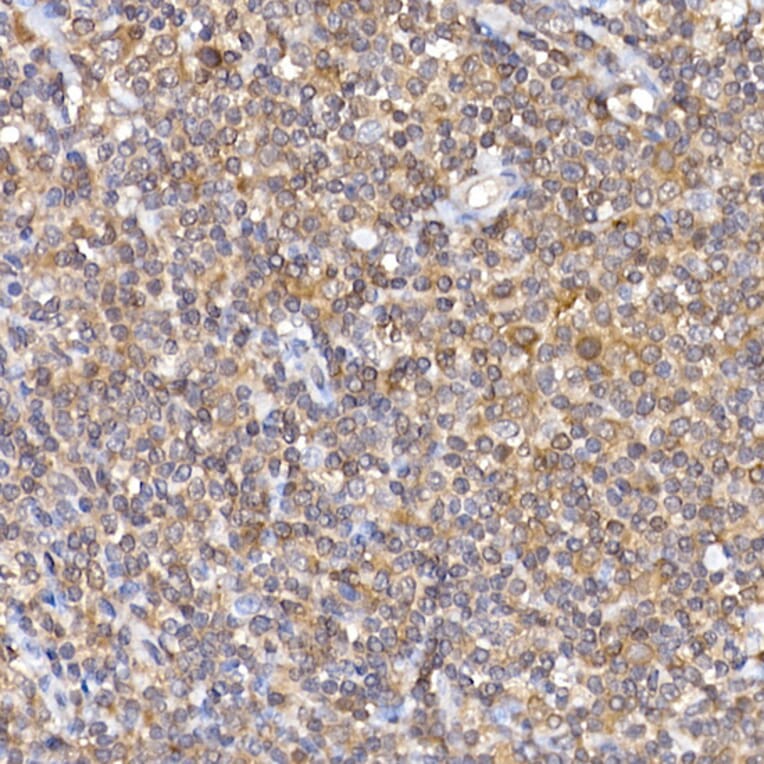 Immunohistochemistry - Anti-NFAT1 Antibody (A14355) - Antibodies.com