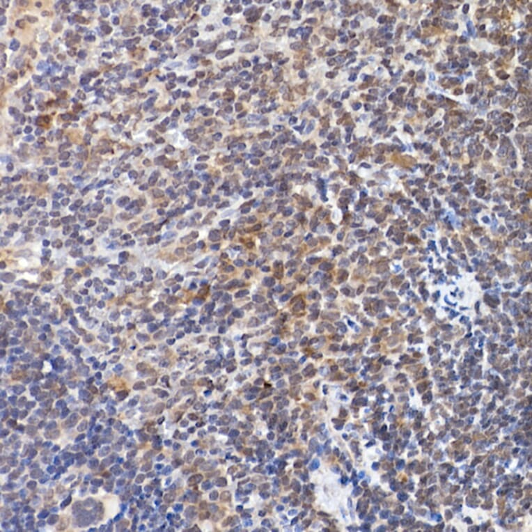 Immunohistochemistry - Anti-NFAT1 Antibody (A14355) - Antibodies.com