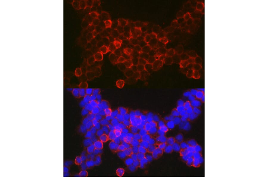Immunofluorescence - Anti-NFAT1 Antibody (A14355) - Antibodies.com