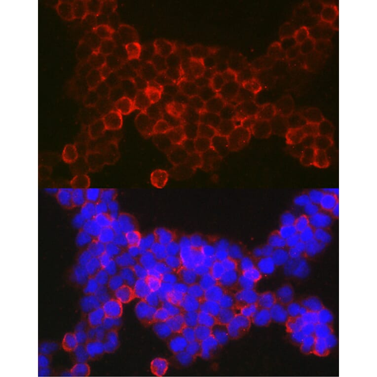 Immunofluorescence - Anti-NFAT1 Antibody (A14355) - Antibodies.com
