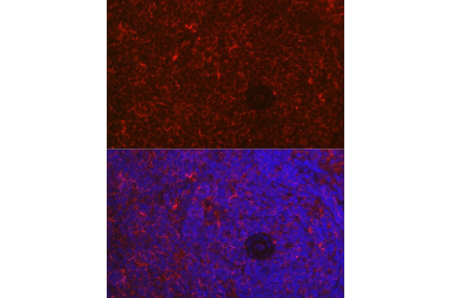 Immunofluorescence - Anti-NFAT1 Antibody (A14355) - Antibodies.com