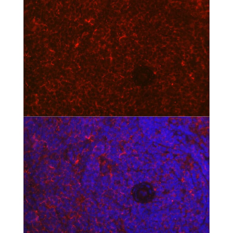 Immunofluorescence - Anti-NFAT1 Antibody (A14355) - Antibodies.com