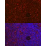 Immunofluorescence - Anti-NFAT1 Antibody (A14355) - Antibodies.com