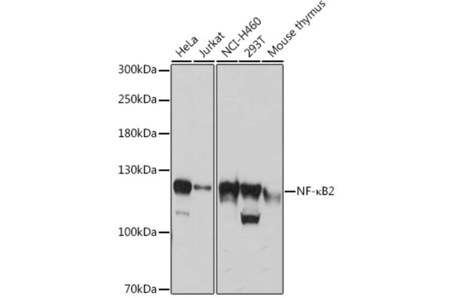 Western Blot - Anti-NFkB p100/NFKB2 Antibody (A14356) - Antibodies.com