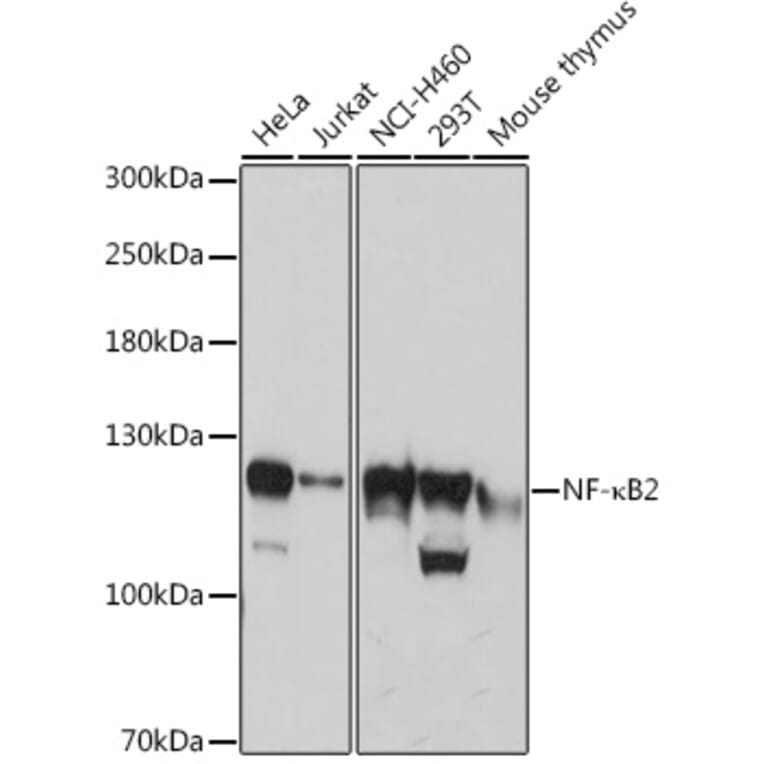 Western Blot - Anti-NFkB p100/NFKB2 Antibody (A14356) - Antibodies.com