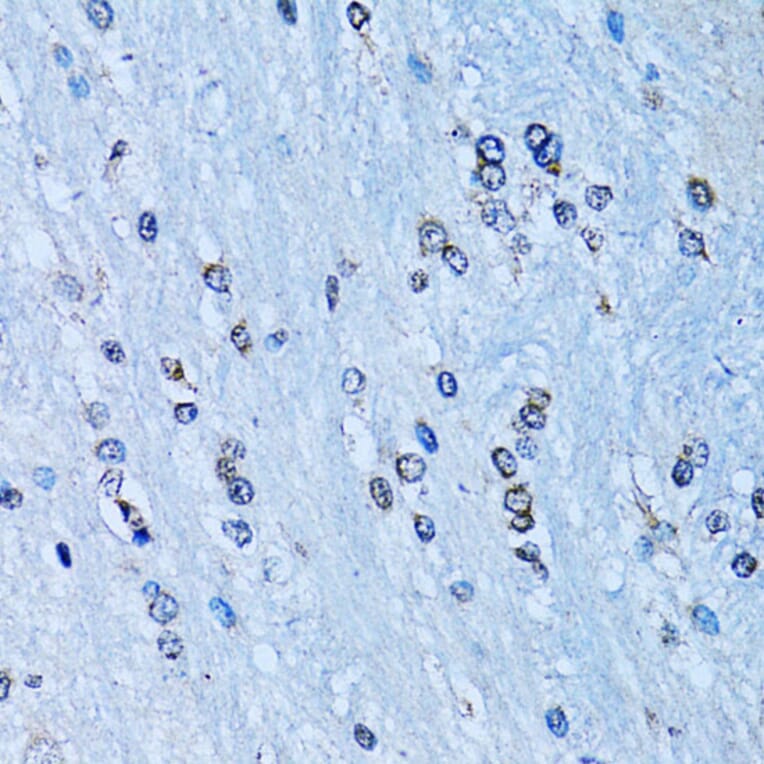 Immunohistochemistry - Anti-NFkB p100/NFKB2 Antibody (A14356) - Antibodies.com