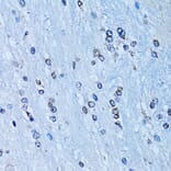 Immunohistochemistry - Anti-NFkB p100/NFKB2 Antibody (A14356) - Antibodies.com