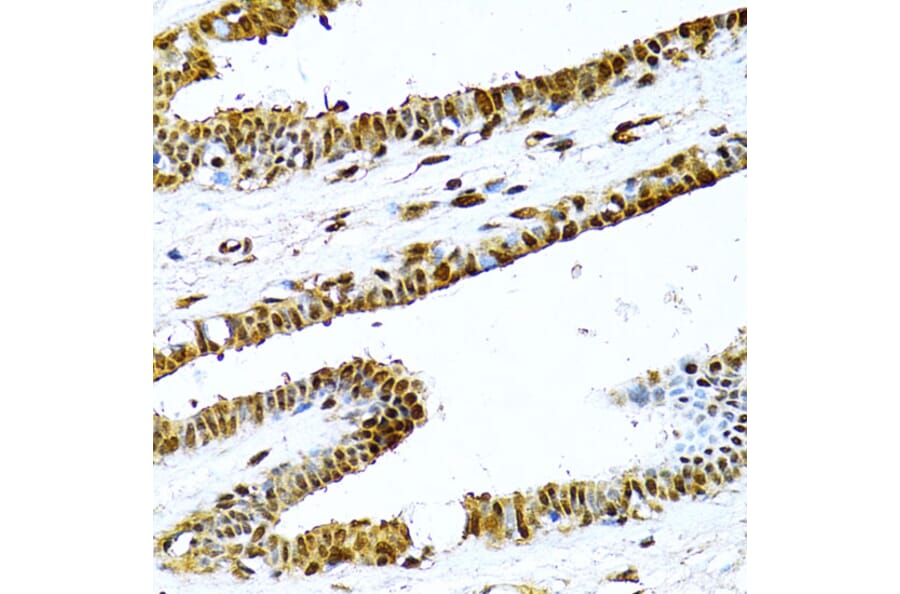 Immunohistochemistry - Anti-NFkB p100/NFKB2 Antibody (A14356) - Antibodies.com