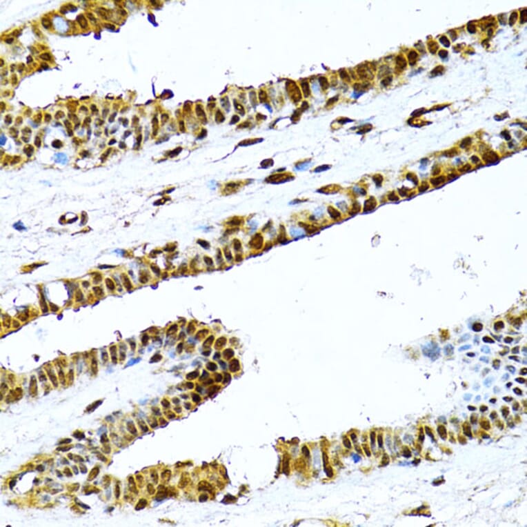 Immunohistochemistry - Anti-NFkB p100/NFKB2 Antibody (A14356) - Antibodies.com