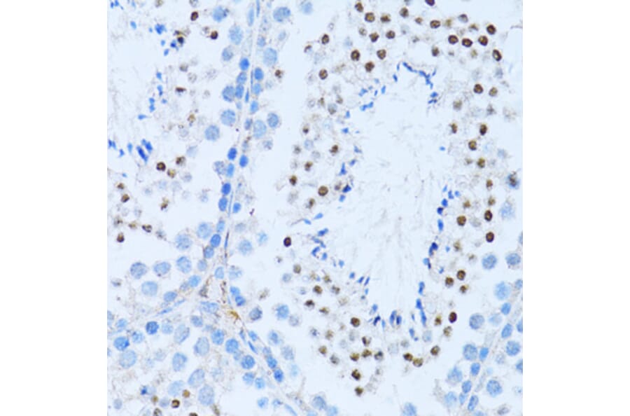 Immunohistochemistry - Anti-NFkB p100/NFKB2 Antibody (A14356) - Antibodies.com