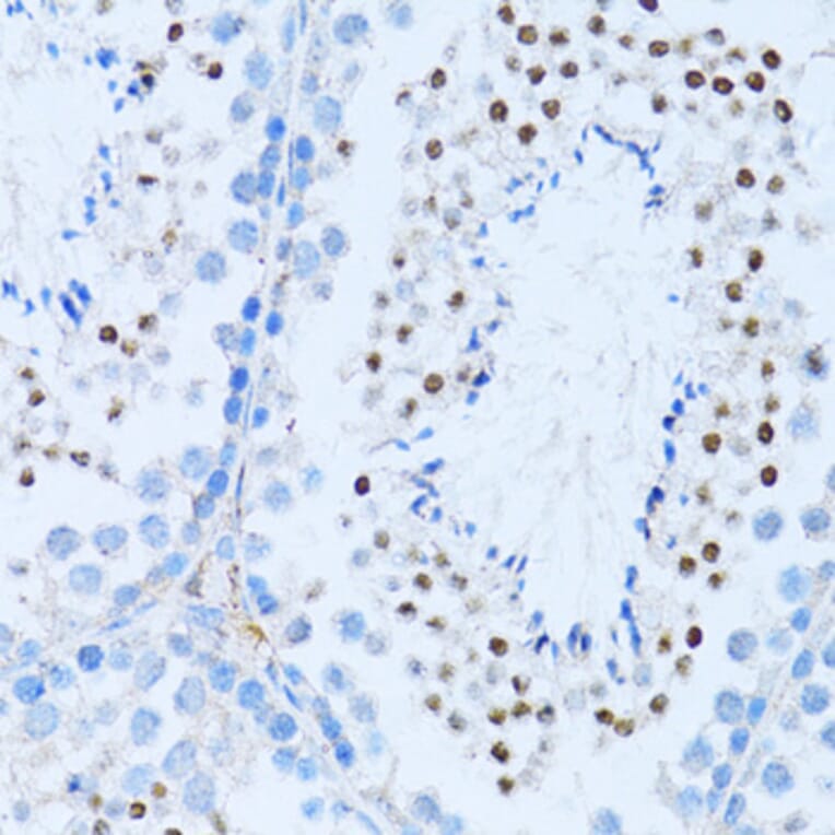 Immunohistochemistry - Anti-NFkB p100/NFKB2 Antibody (A14356) - Antibodies.com