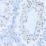 Immunohistochemistry - Anti-NFkB p100/NFKB2 Antibody (A14356) - Antibodies.com