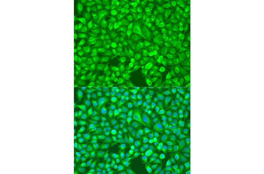 Immunofluorescence - Anti-NFkB p100/NFKB2 Antibody (A14356) - Antibodies.com