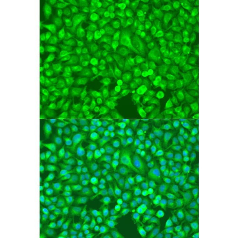 Immunofluorescence - Anti-NFkB p100/NFKB2 Antibody (A14356) - Antibodies.com